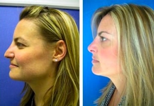 Simoni Plastic Surgery
