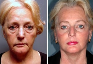 Simoni Plastic Surgery