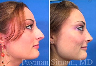 Simoni Plastic Surgery