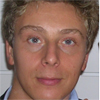 Andrea BALLINI