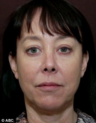 Before and after: Miki Keller, a 49-year-old woman, has undergone an experimental face-lift that involves local anesthetic rather than full anesthesia. She is seen before the surgery (left) and then once it has healed (right)