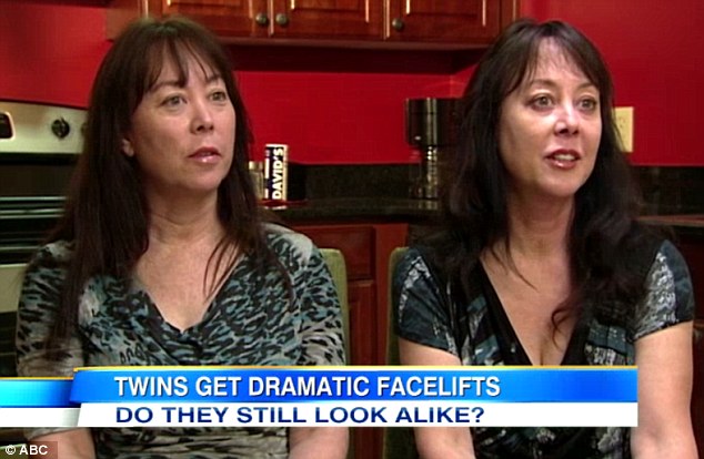 Support: Miki Keller (right) is the twin sister of Donna (left), who underwent a traditional facelift at the same time