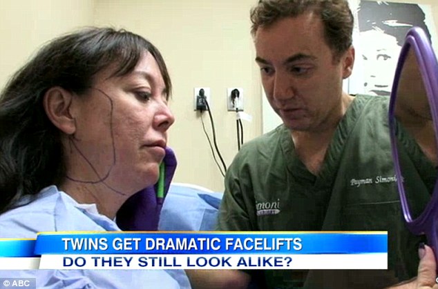 Expert: Dr Simoni (right) begins to prep Miki for surgery. His proposed surgical lines are seen on her face