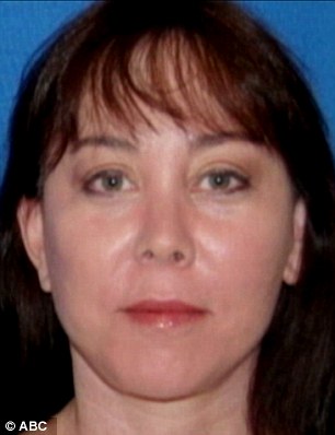 Results: Donna Keller seen prior to her traditional, full anesthesia facelift (left) and then afterwards (right)